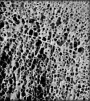 Microscopic image of a normal bone